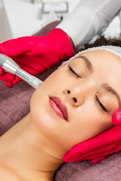 Beautiful woman receiving microneedling rejuvenation treatment. Mesotherapy.